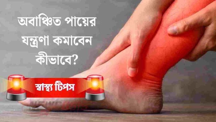 Natural Home remedies for leg pain and swelling​