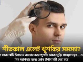 Find Out How to Avoid Dandruff in Winter Naturally