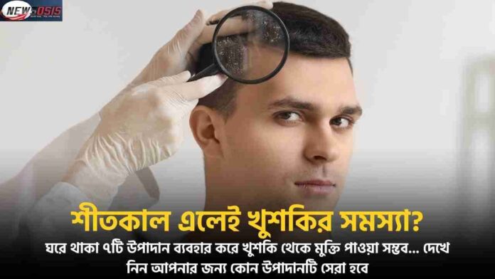 Find Out How to Avoid Dandruff in Winter Naturally